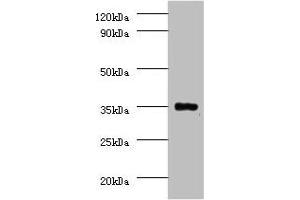 Western blot All lanes: Serine/threonine-protein phosphatase 2A catalytic subunit beta isoform Antibody at 2 μg/mL + EC109 whole cell lysate Secondary Goat polyclonal to rabbit IgG at 1/15000 dilution Predicted band size: 34 kDa Observed band size: 34 kDa