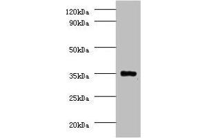 Western blot All lanes: Serine/threonine-protein phosphatase 2A catalytic subunit beta isoform Antibody at 2 μg/mL + EC109 whole cell lysate Secondary Goat polyclonal to rabbit IgG at 1/15000 dilution Predicted band size: 34 kDa Observed band size: 34 kDa (PPP2CB 抗体  (Catalytic Subunit beta))