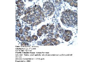 Immunohistochemistry (IHC) image for anti-Small Nuclear RNA Activating Complex, Polypeptide 1, 43kDa (SNAPC1) (C-Term) antibody (ABIN2792633)