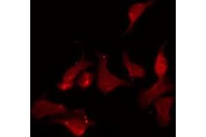 Immunofluorescence (fixed cells) (IF/ICC) image for anti-Solute Carrier Family 16, Member 14 (Monocarboxylic Acid Transporter 14) (SLC16A14) (Internal Region) antibody (ABIN6257044)