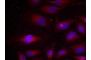 Immunofluorescence staining of methanol-fixed HeLa cells using NF-kappa,B p100(phospho-Ser870) antibody. (NFKB2 抗体  (pSer870))