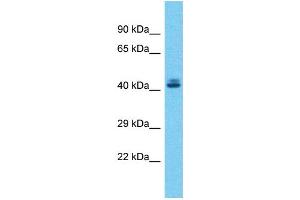 Host:  Rabbit  Target Name:  ZSCAN5A  Sample Type:  Liver tumor lysates  Antibody Dilution:  1. (ZSCAN5A 抗体  (C-Term))