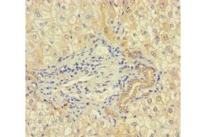 Immunohistochemistry of paraffin-embedded human liver tissue using ABIN7168083 at dilution of 1:100 (RIBC1 抗体  (AA 1-200))