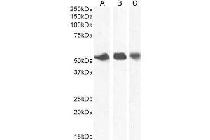 ABIN2613420 (1µg/ml) staining of Human Breast (A), Placenta (B) and Spleen (C) lysate. (SLC29A1 抗体  (N-Term))