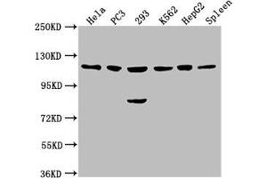 Western Blot Positive WB detected in: Hela whole cell lysate, PC3 whole cell lysate, 293 whole cell lysate, K562 whole cell lysate, HepG2 whole cell lysate, Rat spleen tissue All lanes: CDKL5 antibody at 1:2000 Secondary Goat polyclonal to rabbit IgG at 1/50000 dilution Predicted band size: 116, 108 kDa Observed band size: 116 kDa (CDKL5 抗体  (AA 790-921))