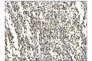 IHC analysis of SUMO2/3 using anti-SUMO2/3 antibody (ABIN7600856). (SUMO2/3 抗体  (AA 24-72))