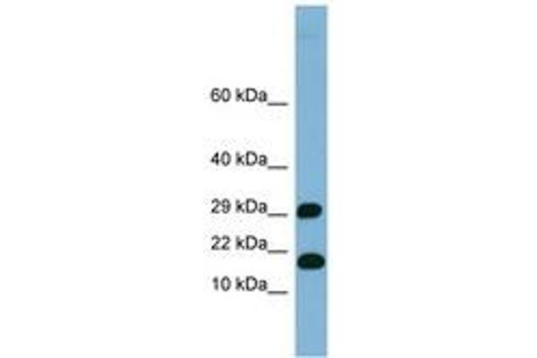 TRAPPC2L 抗体  (N-Term)