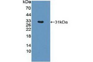 Detection of Recombinant MHCDRb1, Mouse using Polyclonal Antibody to HLA Class II Histocompatibility Antigen, DRB1 Beta Chain (HLA-DRB1)