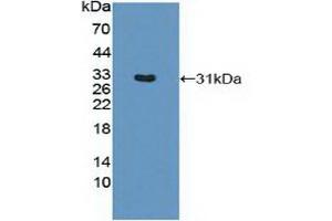 Detection of Recombinant MHCDRb1, Mouse using Polyclonal Antibody to HLA Class II Histocompatibility Antigen, DRB1 Beta Chain (HLA-DRB1) (HLA-DRB1 抗体  (AA 27-264))