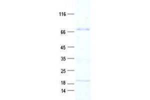 ZNF234 Protein (His tag)