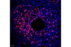 Immunofluorescence of paraffin embedded mouse ovary using Top2 (ABIN7075937) at dilution of 1:500 (400x lens) (Topoisomerase II alpha 抗体)