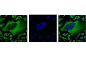 IF analysis of Hela with β-Tubulin Monoclonal Antibody(Left) and DAPI (Right) diluted at 1:100. (TUBB3 抗体)