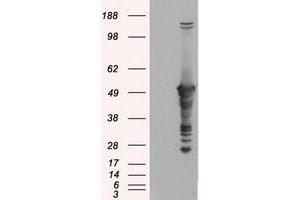 Image no. 1 for anti-Glial Fibrillary Acidic Protein (GFAP) antibody (ABIN1498437) (GFAP 抗体)