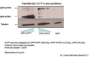 MTUS1 antibody - middle region  validated by WB using MCF-7, HeLa, and human cancer cell lines at 1:2000.