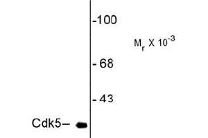 Western Blotting (WB) image for anti-Cyclin-Dependent Kinase 5 (CDK5) antibody (ABIN782438) (CDK5 抗体)
