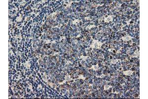 Immunohistochemical staining of paraffin-embedded Human lymph node tissue using anti-TACC3 mouse monoclonal antibody. (TACC3 抗体)