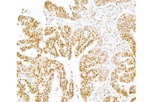 Immunohistochemistry (IHC) image for anti-RNA Polymerase II (pSer5) antibody (ABIN7455032) (RNA Polymerase II 抗体  (pSer5))