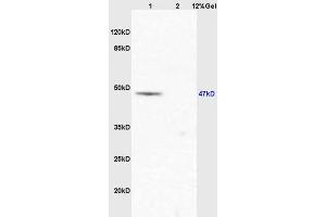 Lane 1: mouse lung lysates Lane 2: mouse stomach lysates probed with Anti EIF5 Polyclonal Antibody, Unconjugated (ABIN1387374) at 1:200 in 4 °C. (EIF5 抗体  (AA 331-431))