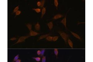 Immunofluorescence analysis of NIH-3T3 cells using NDUFA5 Polyclonal Antibody at dilution of 1:100 (40x lens). (NDUFA5 抗体)