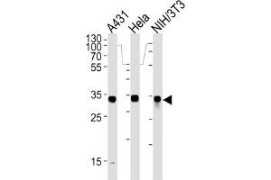 Western Blotting (WB) image for anti-Malate Dehydrogenase 2, NAD (Mitochondrial) (MDH2) antibody (ABIN3001706)