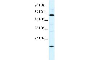 Human HepG2; WB Suggested Anti-ZNF436 Antibody Titration: 1. (ZNF436 抗体  (N-Term))