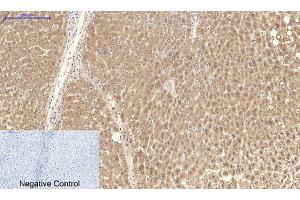 Immunohistochemical analysis of paraffin-embedded human liver tissue. (Catalase 抗体  (C-Term))