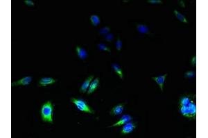Immunofluorescent analysis of HepG2 cells using ABIN7171866 at dilution of 1:100 and Alexa Fluor 488-congugated AffiniPure Goat Anti-Rabbit IgG(H+L) (TSPAN31 抗体  (AA 94-173))