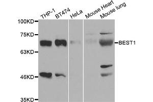 Western blot analysis of extracts of various cell lines, using BEST1 antibody. (Bestrophin 1 抗体)