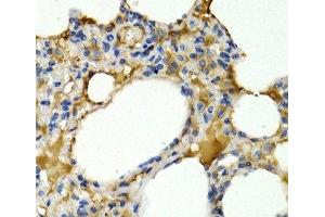 Immunohistochemistry of paraffin-embedded Rat lung using IL9 Polyclonal Antibody at dilution of 1:200 (40x lens). (IL-9 抗体)