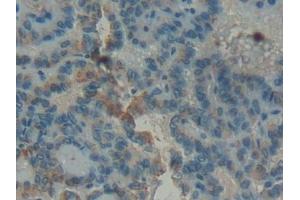 Immunohistochemistry (IHC) image for anti-Glucosidase, Beta, Acid (GBA) (AA 117-214) antibody (ABIN7434968)