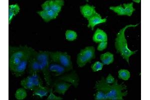 Immunofluorescence staining of MCF-7 cells with ABIN7139755 at 1:50, counter-stained with DAPI. (CAMK2N2 抗体  (AA 10-28))