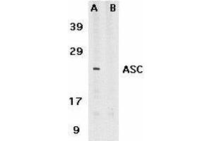Immunocytochemistry of ASC in HL60 cells with ASC antibody at 5μg/ml. (PYCARD 抗体  (C-Term))