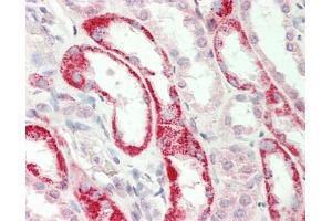 Human Kidney: Formalin-Fixed, Paraffin-Embedded (FFPE). (GATM 抗体  (AA 251-300))