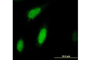 Immunofluorescence (IF) image for anti-Ribosomal Protein S6 Kinase, 90kDa, Polypeptide 3 (RPS6KA3) (AA 2-95) antibody (ABIN519891)