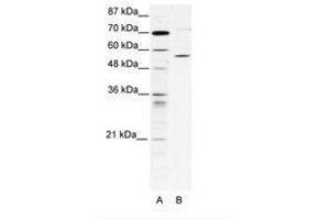 Image no. 1 for anti-Chaperonin Containing TCP1, Subunit 4 (Delta) (CCT4) (AA 453-502) antibody (ABIN202730) (CCT4 抗体  (AA 453-502))