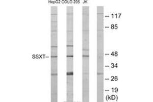 Western blot analysis of extracts from HepG2/Jurkat/COLO205 cells, using SSXT Antibody.