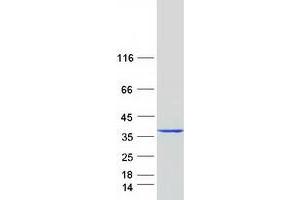 Western Blotting (WB) image for Annexin A13 (ANXA13) (Transcript Variant 1) protein (Myc-DYKDDDDK Tag) (ABIN2714734)
