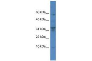 Image no. 1 for anti-Cathepsin C (CTSC) (AA 185-234) antibody (ABIN6746757) (CTSC 抗体  (AA 185-234))