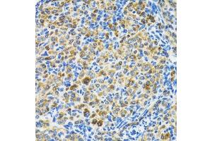 Immunohistochemistry of paraffin-embedded rat ovary using HSPA9 antibody. (HSPA9 抗体  (AA 380-679))