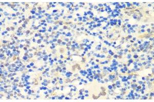 Immunohistochemistry of paraffin-embedded Rat spleen using CTCF Polyclonal Antibody at dilution of 1:200 (40x lens). (CTCF 抗体)