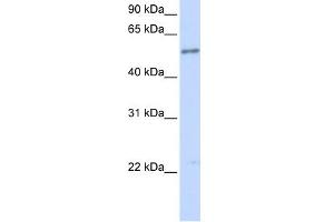 WB Suggested Anti-IL1RL1 Antibody Titration:  0.