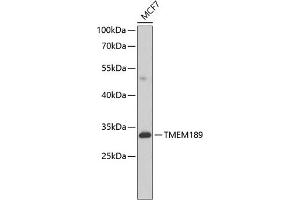 Western blot analysis of extracts of MCF-7 cells, using TMEM189 antibody (ABIN6134447, ABIN6149262, ABIN6149263 and ABIN6224423) at 1:1000 dilution. (TMEM189 抗体  (C-Term))