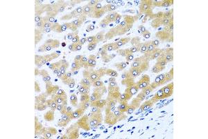 Immunohistochemistry of paraffin-embedded human liver using CCL21 antibody (ABIN5970974) at dilution of 1/100 (40x lens). (CCL21 抗体)