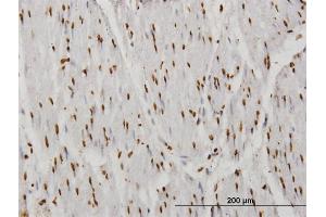 Immunoperoxidase of monoclonal antibody to TAF11 on formalin-fixed paraffin-embedded human smooth muscle. (TAF11 抗体  (AA 158-210))