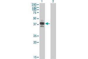 Western Blot analysis of CD2 expression in transfected 293T cell line by CD2 MaxPab polyclonal antibody. (CD2 抗体  (AA 1-351))