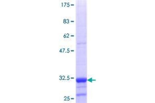 SLC22A12 Protein (AA 281-349) (GST tag)