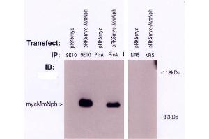 Image no. 1 for anti-Nephronophthisis 1 (Juvenile) (NPHP1) antibody (ABIN264966) (NPHP1 抗体)