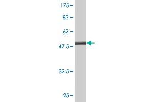 Western Blot detection against Immunogen (47. (SSSCA1 抗体  (AA 1-199))