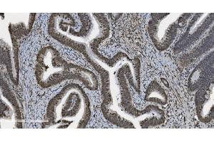 IHC analysis of U2AF65/U2AF2 using anti U2AF65/U2AF2 antibody (ABIN7600795). (U2AF2 抗体  (AA 238-470))