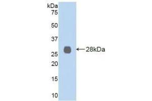 Detection of Recombinant LOXL2, Human using Polyclonal Antibody to Lysyl Oxidase Like Protein 2 (LOXL2) (LOXL2 抗体  (AA 544-751))